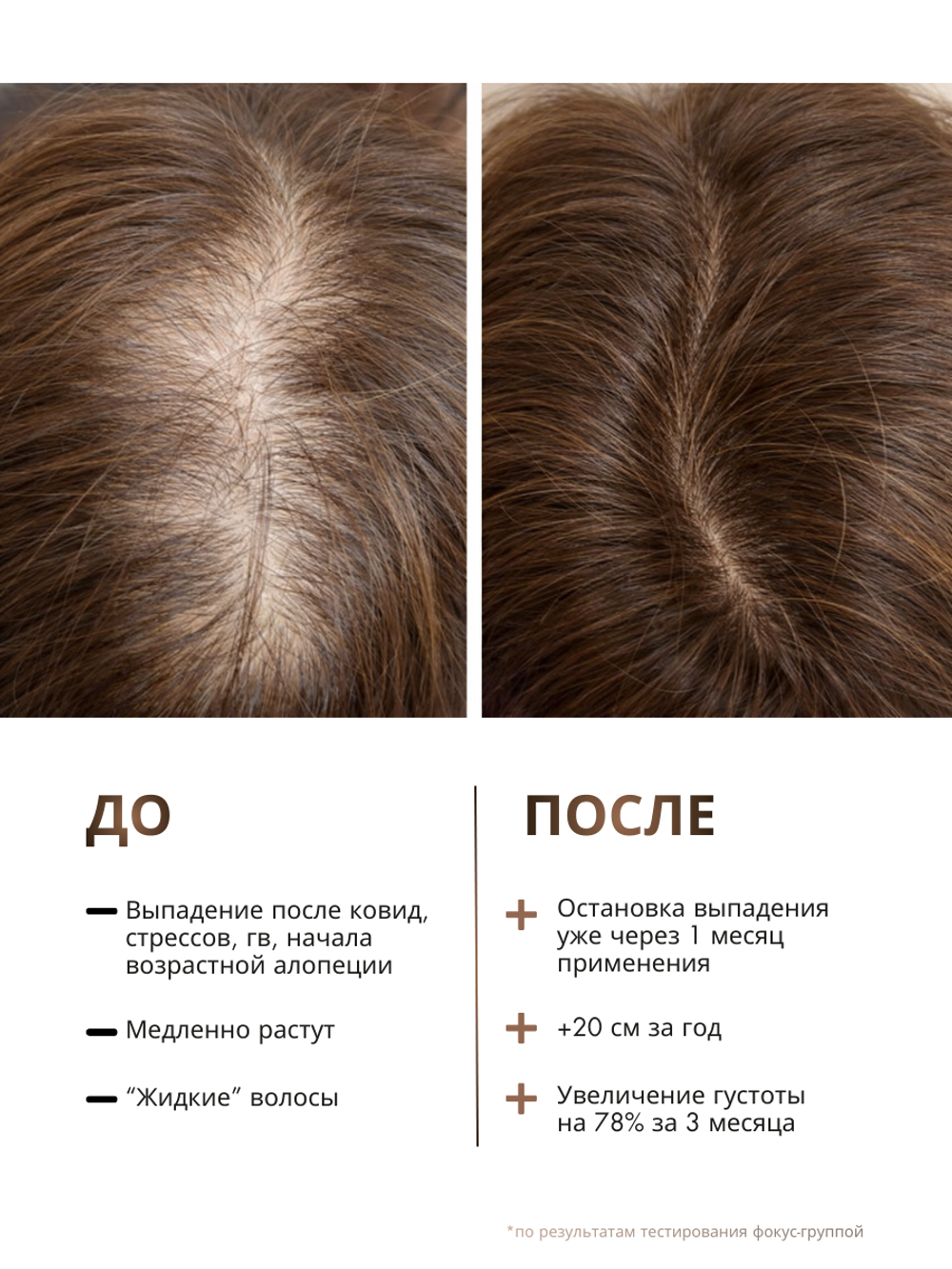 Шампунь от выпадения и для роста волос GROW IT