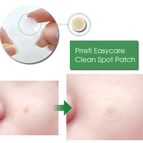Точечные патчи от прыщей Prreti Easycare Clean Spot Patch, 88шт в 1 уп