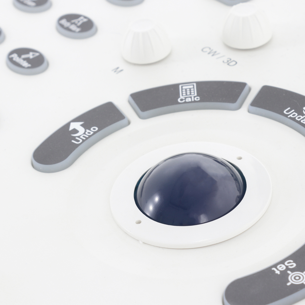 Аппарат ультразвуковой диагностики Med-Mos ЕМР3000