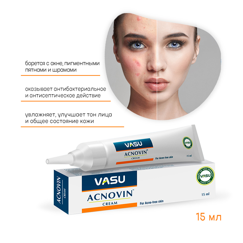 Крем от акне Vasu Acnovin 15 мл