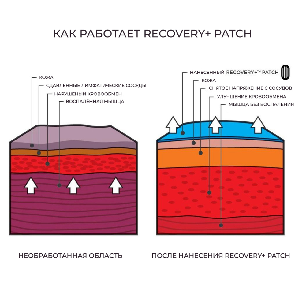 Кинезиотейп KT TAPE Recovery Patch, Аппликация для снятия отеков и воспалений, преднарезанный, 4 шт