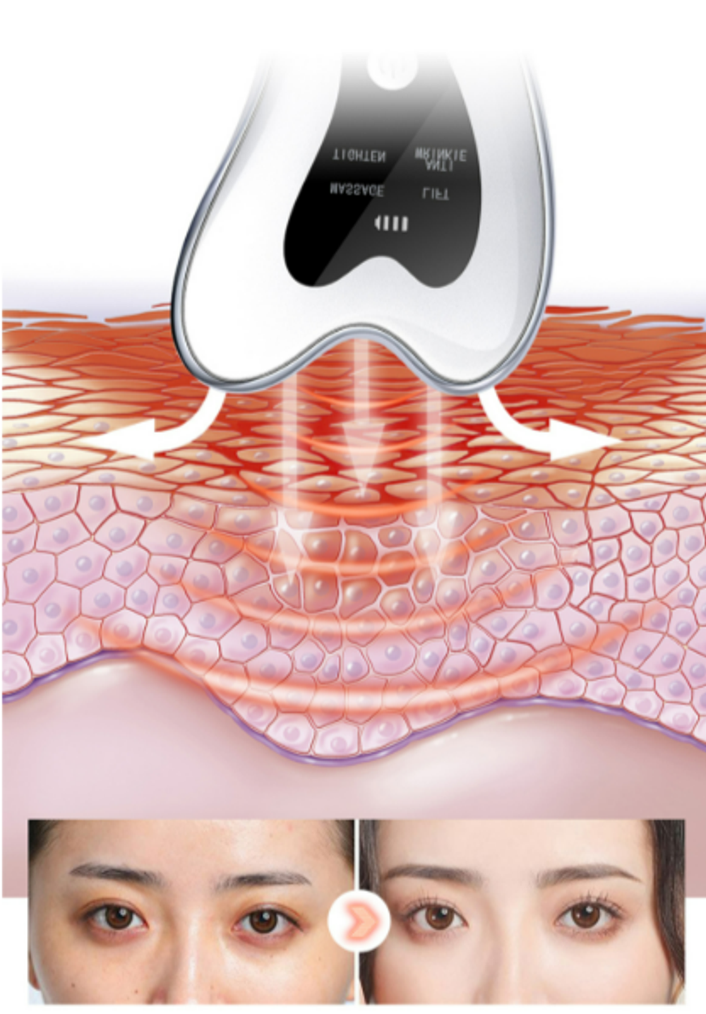 MOMMY CARE Микротоковый гуаша-массажер Galvanic RF Massager