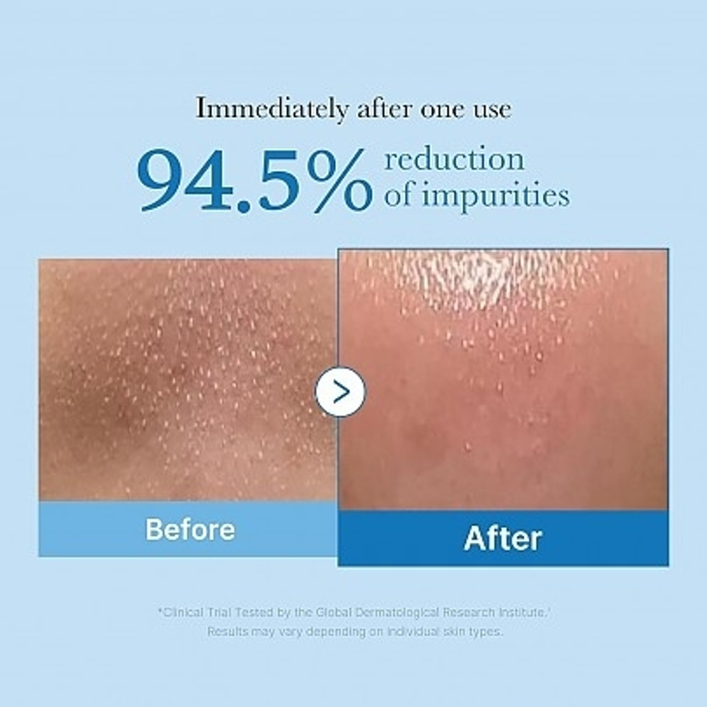 Масло гидрофильное Medicube Zero Pore Blackhead Deep Cleansing Oil, 205 мл