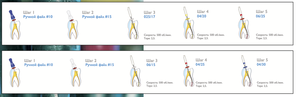 Файлы для первичной эндодонтии Blue Storm SANI