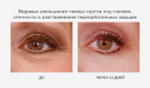 Is Clinical Youth Eye Complex антивозрастной комплекс для кожи вокруг глаз 15 ml