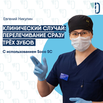 Клинический случай: перелечивание сразу трёх зубов