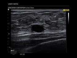 Аппарат УЗИ (сканер) Samsung Medison HM70