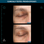 ALLIES OF SKIN Разглаживающая мультипептидная сыворотка с фактором роста Multi Peptides & GF Advanced Lifting Serum, 30 мл