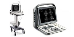 Аппарат УЗИ Sonoscape A6