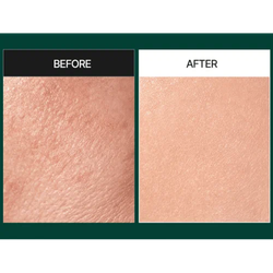 Мягкая пилинг-сыворотка со спикулами и центеллой MEDIPEEL Phyto Cica-Nol B5 3000 Shot Serum 50 мл.