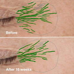 Clinique Smart Clinical Repair Wrinke Correcting Serum - Сыворотка против морщин для лица /   50  ml  / GTIN 192333101681
