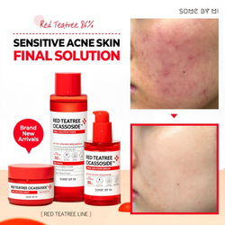 Some By Mi Red Tea Tree Cicassoside Final Solution Toner тонер для проблемной кожи с красным чайным деревом