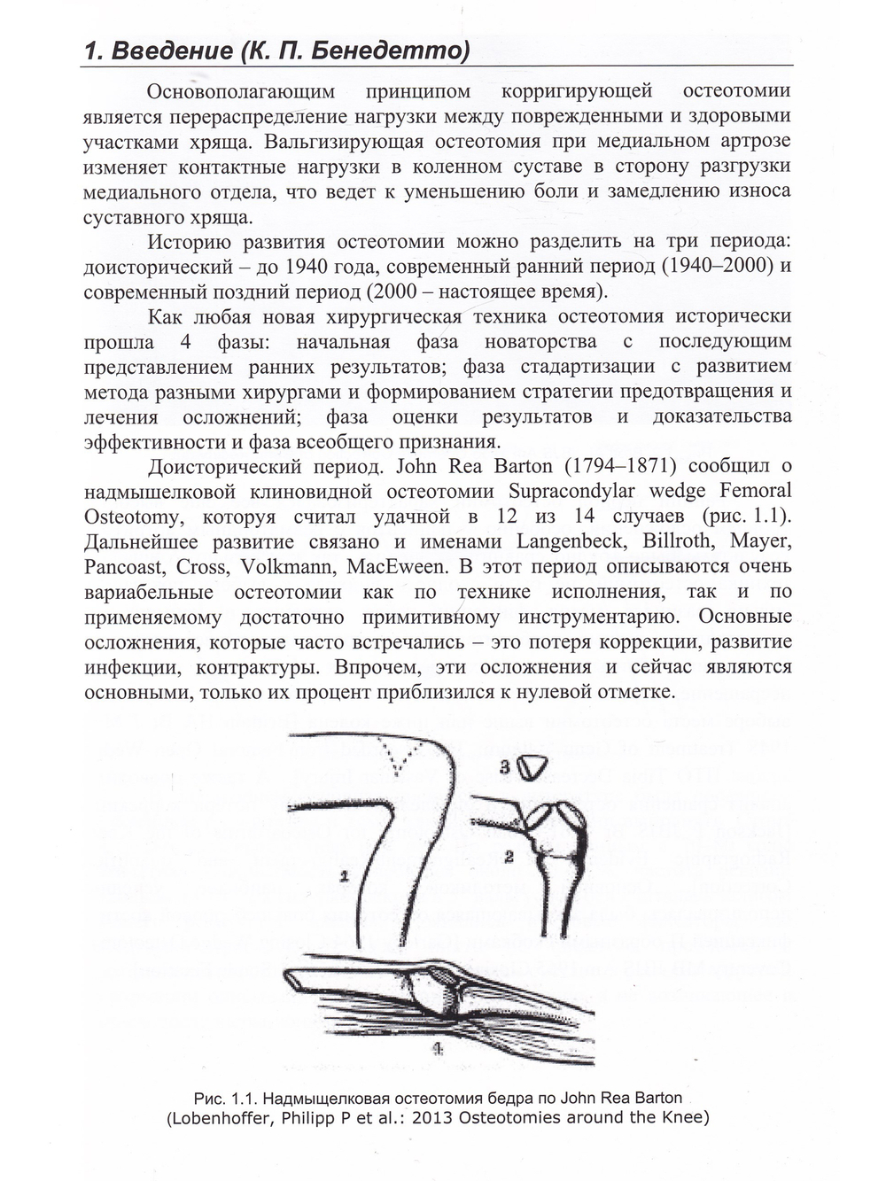 Остеотомии в области коленного сустава