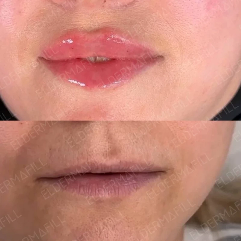 Deep French Kiss Eldermafill