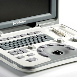 Аппарат УЗИ Sonoscape A6
