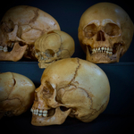 Набор «Череп человека» (анатомические модели)