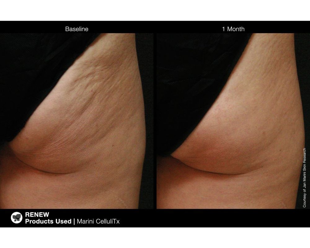 JAN MARINI CELLULITX Высокоэффективный антицеллюлитный крем