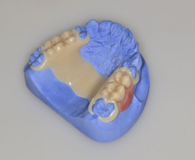 Хороший ацетал производства польской компании РОКО (ROKO)