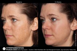 JAN MARINI AGE INTERVENTION RETINOL+ 0,5% Крем-акселератор с ретинолом 0,5% для борьбы с видимыми возрастными изменениями