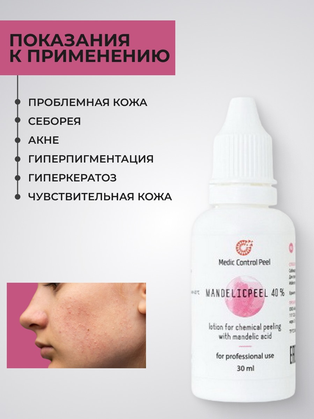 Миндальный пилинг MANDELICPEEL 40 % 30 мл