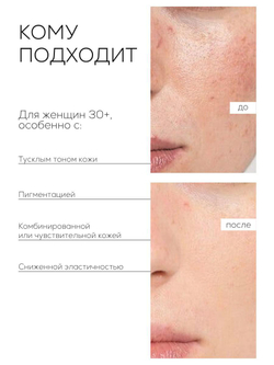 СЫВОРОТКА С НИАЦИНАМИДОМ ДЛЯ СИЯНИЯ И ВЫРАВНИВАНИЯ ТОНА КОЖИ LAURA ZACKARYA™