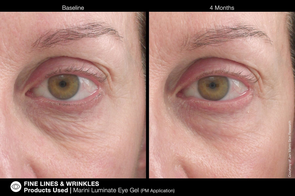 JAN MARINI Luminate Eye Gel Концентрированная сыворотка для кожи вокруг глаз с эффектом сияния против темных кругов и морщин, 15 мл