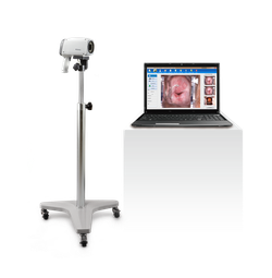 Видеокольпоскоп Edan C6 и Edan C6A