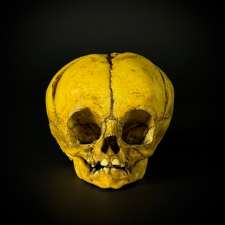 Череп человека ребёнок (анатомическая модель)
