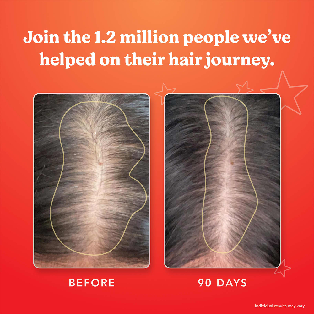 HAIRtamin, Advanced Formula, 30 веганских капсул