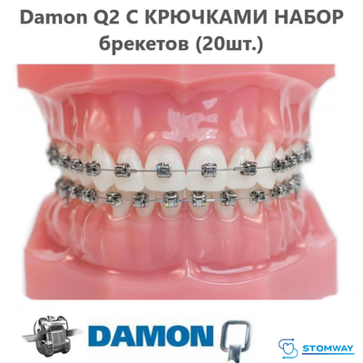 Damon Q2 С КРЮЧКАМИ НАБОР брекетов (20шт.) Даймон Q2, брекеты для верхней и нижней челюстей