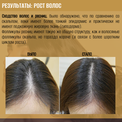 Активатор для роста волос и ресниц OLFACTORIUS "Renaissance", с Capixyl™ 5% (50мл)