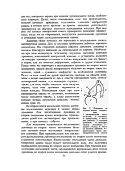 Рентгенодиагностика заболеваний пищеварительного тракта. Том II | В.А. Фанарджян