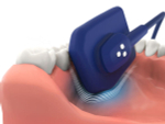 Радиовизиограф EzSensor Soft