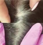 Hair Forest Ampoule Eldermafill | Восстановление волос