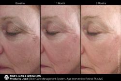 JAN MARINI AGE INTERVENTION RETINOL PLUS MD 1% Крем-акселератор с ретинолом 1% для борьбы с видимыми возрастными изменениями