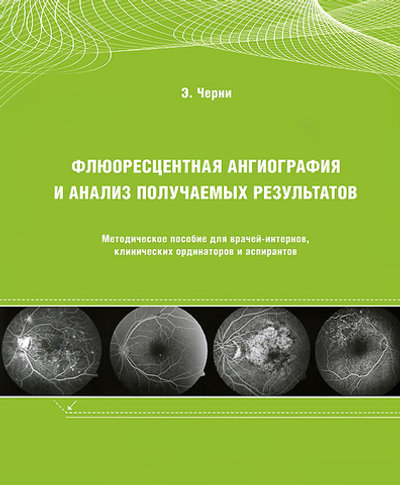 Флюоресцентная ангиография и анализ получаемых результатов: Методическое пособие для врачей-интернов