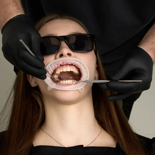 Ретрактор для губ и щек без латекса 480 шт Regular | Small | Junior