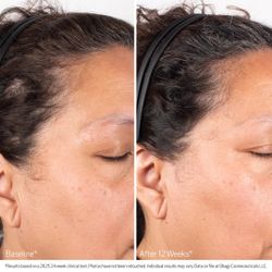 Obagi Medical Cыворотка NU-Cil Biostim для роста и укрепления волос Obagi NU-CIL Biostim Sculp Serum 60 мл