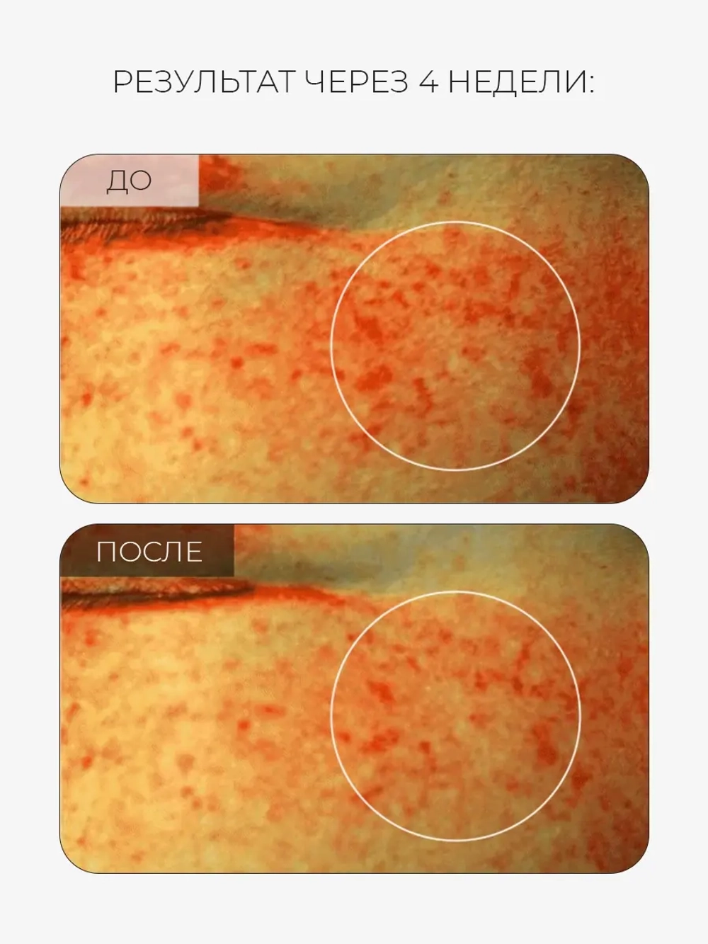 Arocell Солнцезащитная сыворотка с транексамовой кислотой, мелатонином и глутатионом SPF50 Mela TXA Sun Serum 40 мл