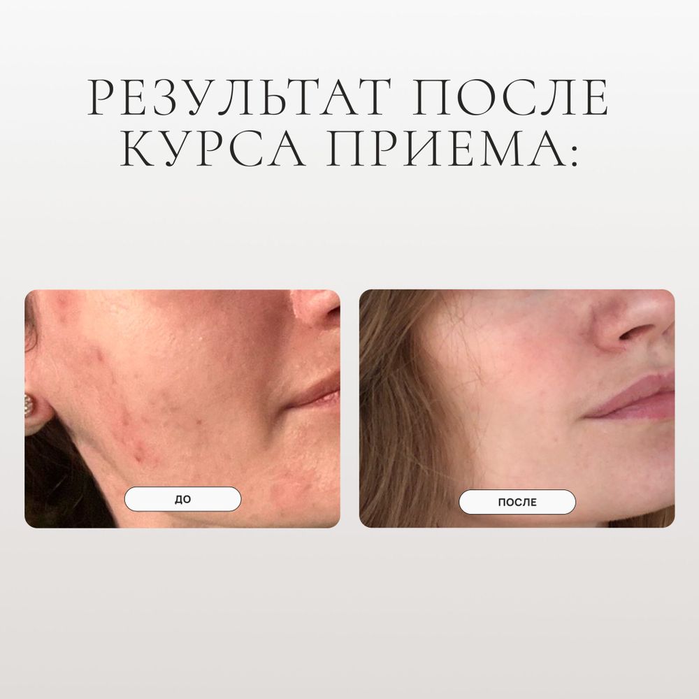 PROBIOLAB COLLAGEN (FISH) POWDER PURE PEPTIDES Морской коллаген (рыбий) порошок чистые пептиды 300 гр