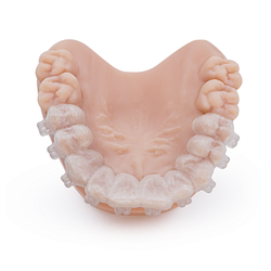 Dental IBT