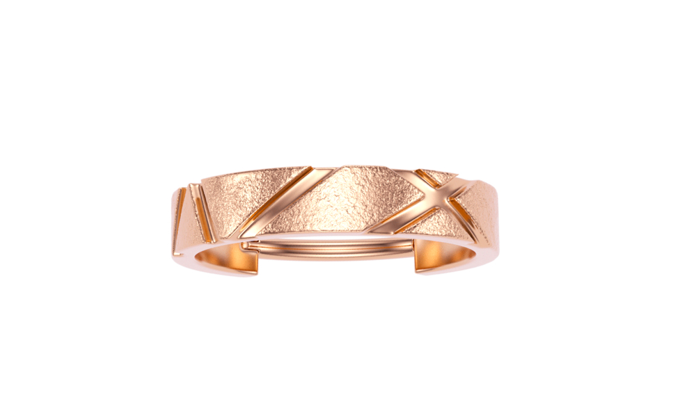 Volar ring