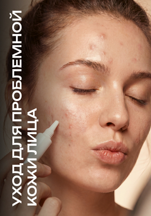 Косметика для проблемной кожи