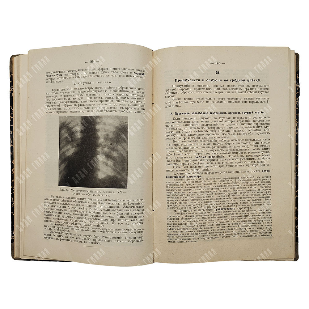 Кервен Ф. [Dr. de Quervain] Частная хирургическая диагностика для студентов и врачей, 1911.