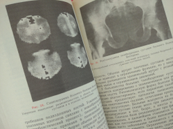 Диагностика и лечение болезней суставов