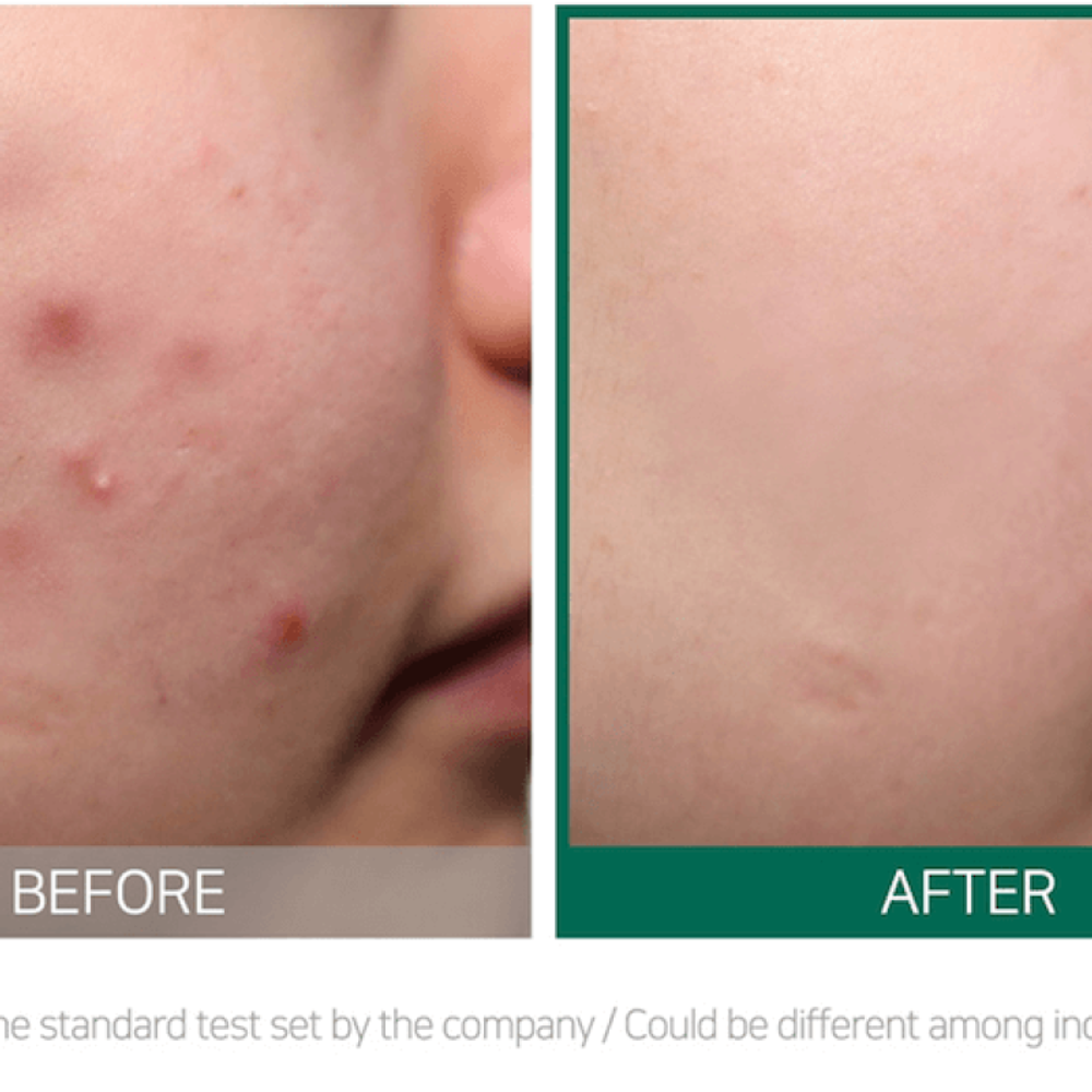 Some By Mi AHA BHA 30 Days Miracle Cream 60g