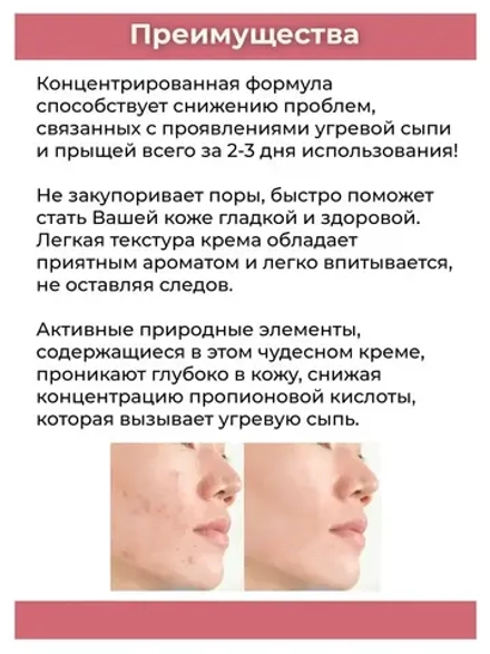 Тайский специализированный крем от угрей.