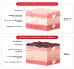 Кинезио тейп BB LYMPH TAPE 5см*5м бежевый Хлопок