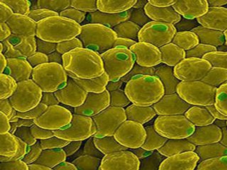 Дрожжи в нашем пиве