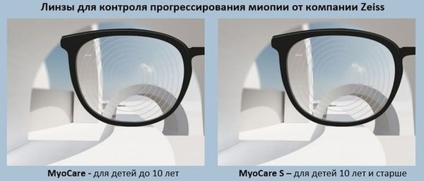 Контроль миопии у детей: инновационные линзы MyoCare от Zeiss и Stellest от Essilor